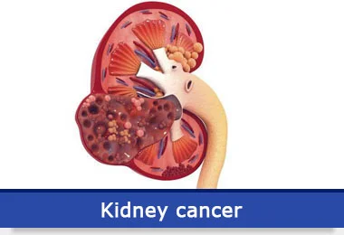 kidney