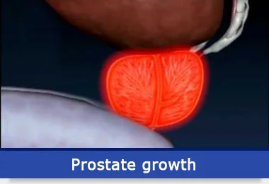 prostate