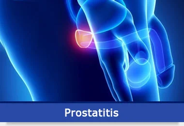 prostatitis